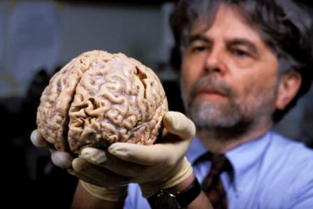 20071116111405-brain.jpg