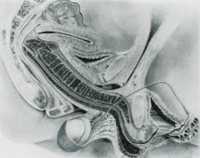 20090316162623-schw4391.gif
